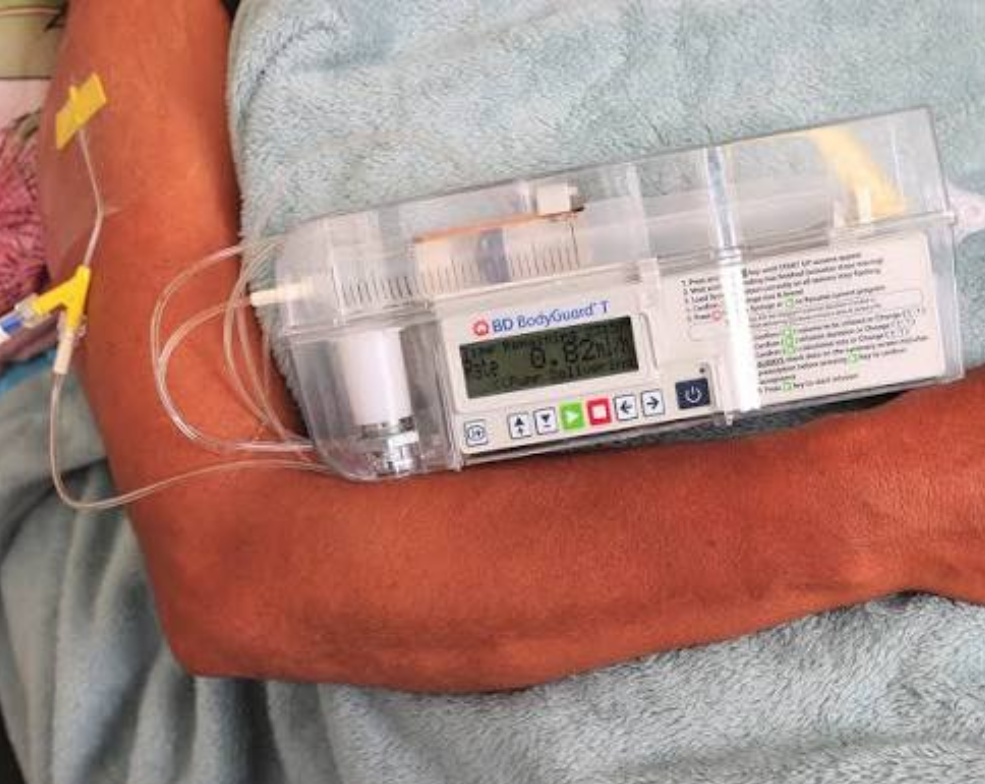 A patient wearing a syringe driver on their arm